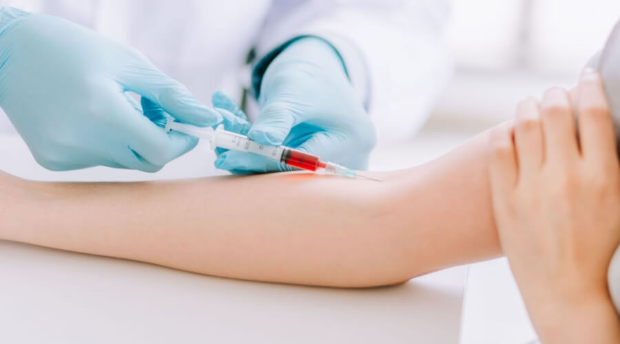 السحب المنزلي - الهرمونات - مختبر رويال الطبي